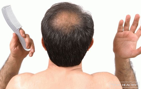 Non ci sarà calvizie: come sapere in anticipo e prevenire la caduta dei capelli negli uomini