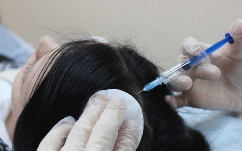 trattamento ad ultrasuoni per capelli