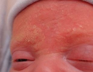 irritazione sulla foto della testa del bambino