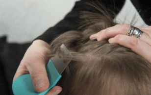 pidocchi e lendini nel trattamento fotografico dei capelli